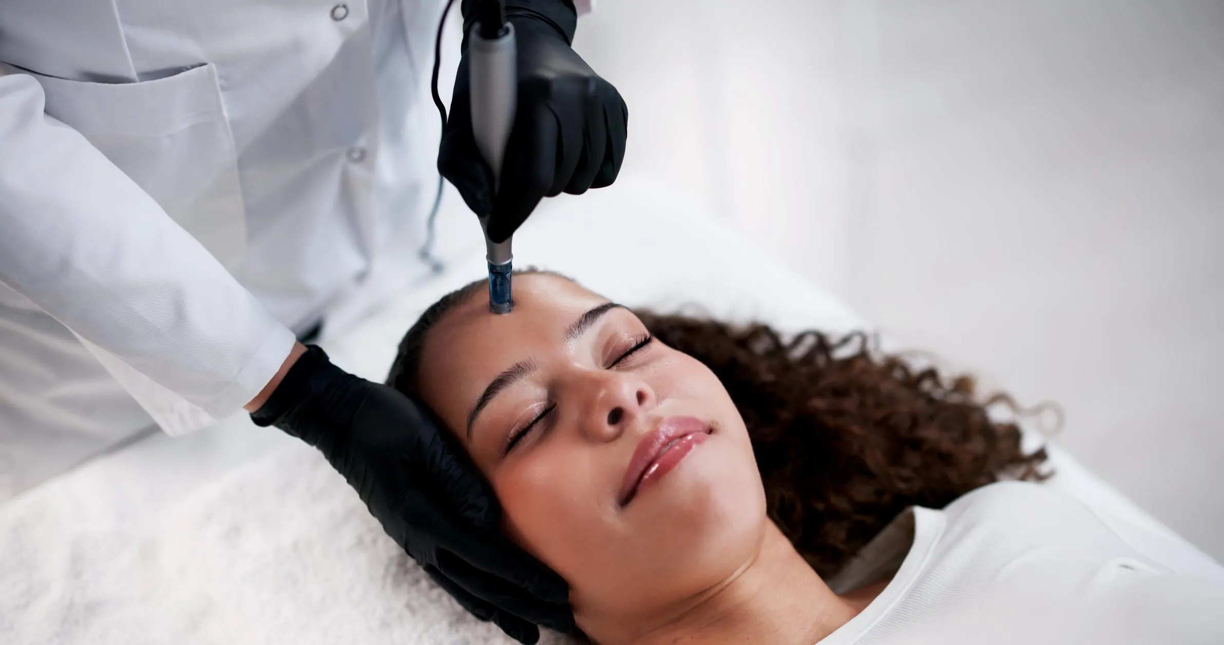 Microneedling Treatment